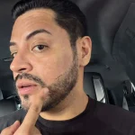 Eduin Caz, vocalista de Grupo Firme, muestra una pequeña cicatriz en la mejilla izquierda después de un procedimiento para retirar un absceso.