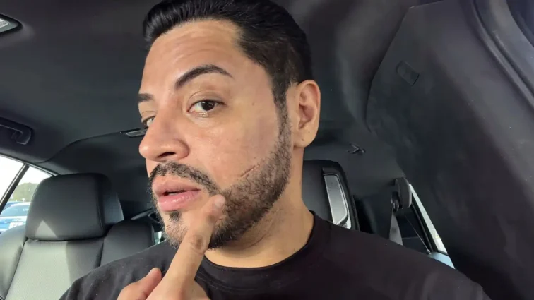 Eduin Caz rompe el silencio tras su hospitalización: revela qué le retiraron de la mejilla